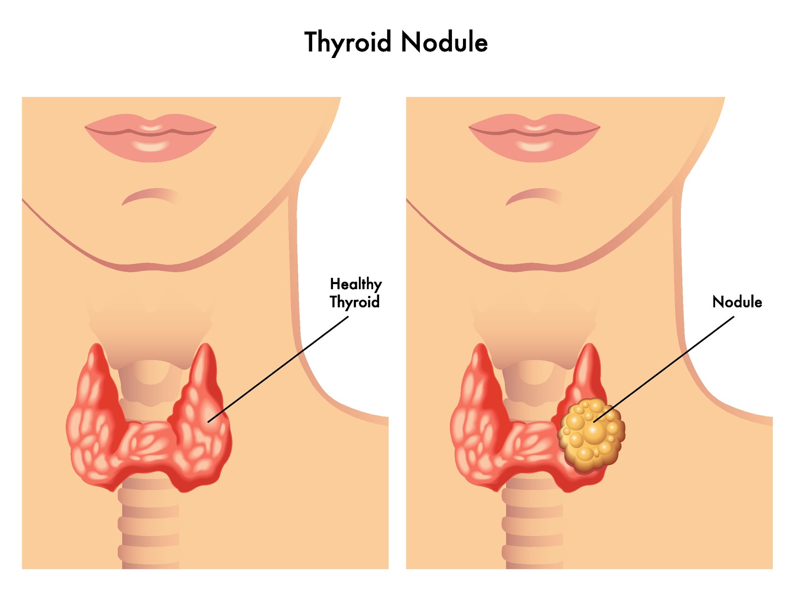 Doctor discussing treatment plan