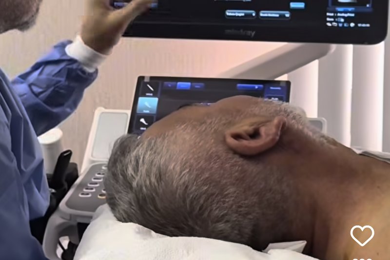 Tiroid Nodüllerinde Mikrodalga Ablasyon Tedavisi Uygulama ve İyileşme Süreci - Prof. Dr. Aykut Recep Aktaş